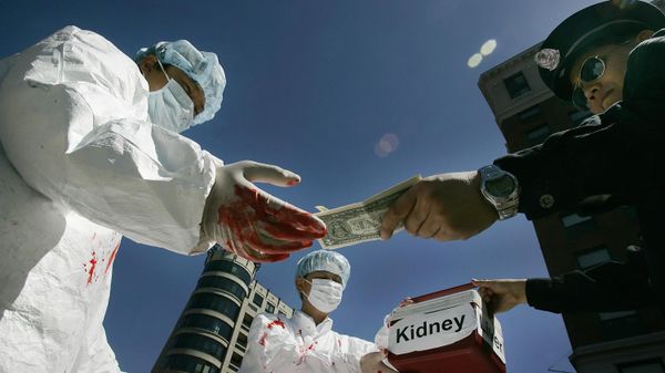 Kidney