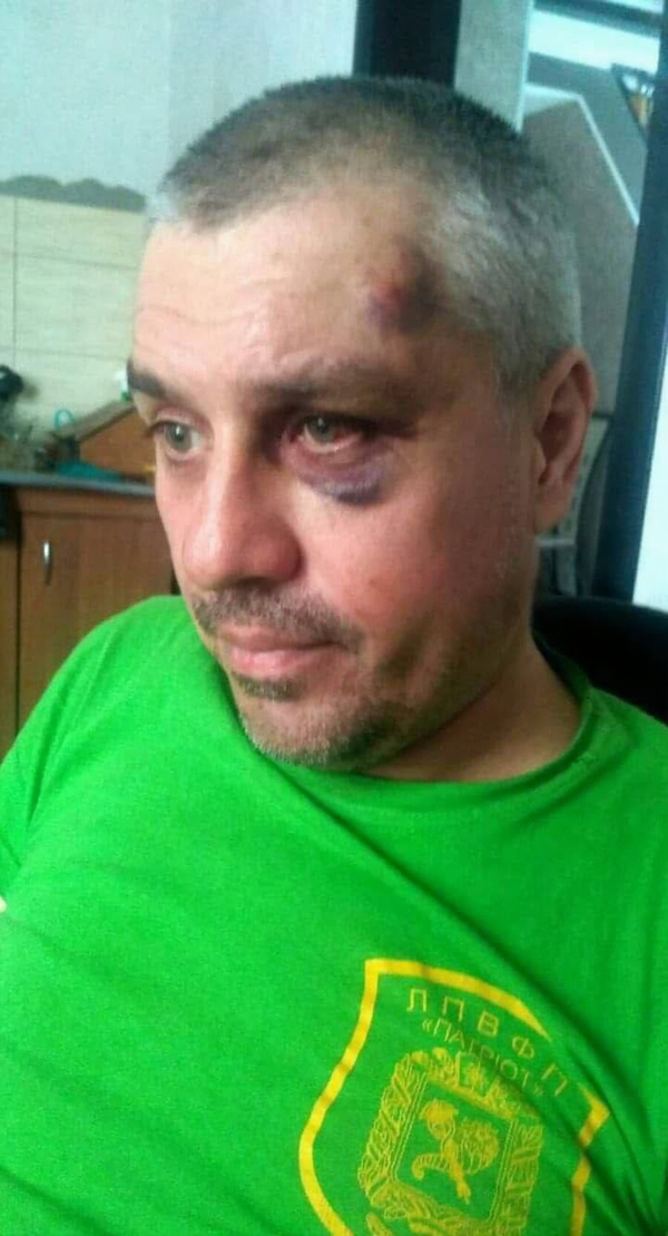Вячеслав Артюхов со следами побоев Вячеслав Артюхов со следами побоев