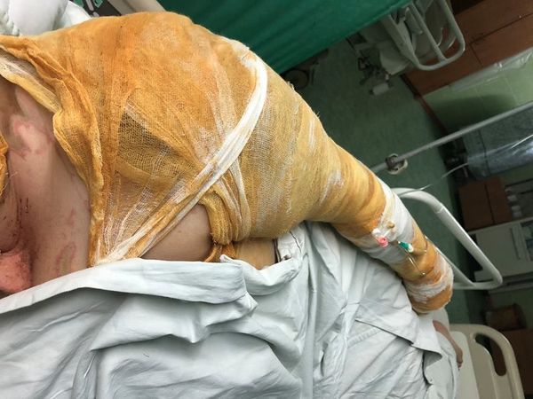 Екатерина Гандзюк в больнице