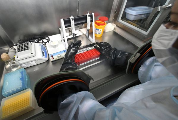Тест-системы для диагностики нового коронавируса Тест-системы для диагностики нового коронавируса