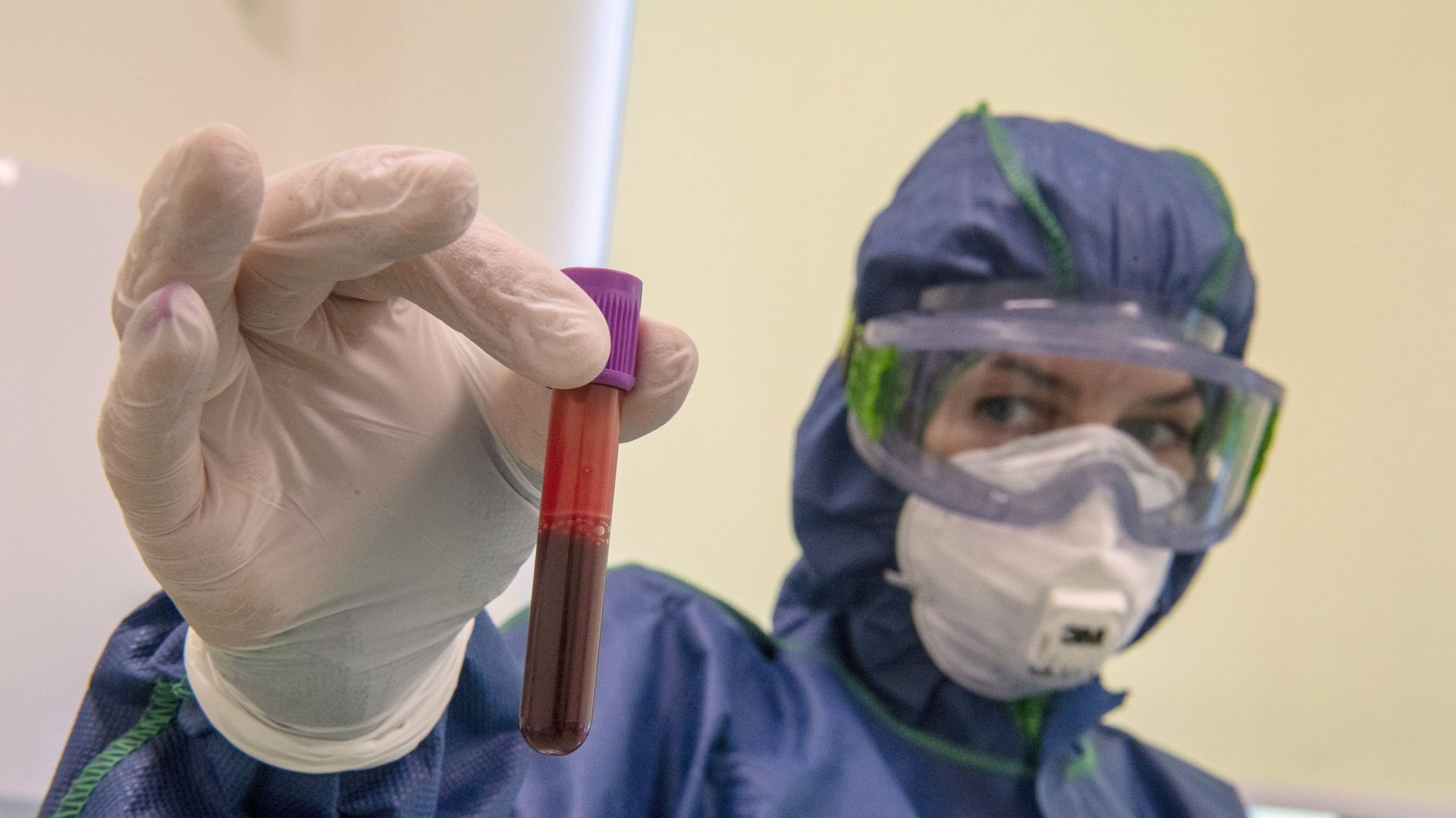 Экспресс-диагностика на антитела к коронавирусу в клинике Hadassah Medical Moscow в Сколково - РИА Новости, 1920, 04.11.2020