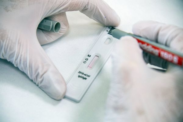 Экспресс-диагностика на антитела к коронавирусу в клинике Hadassah Medical Moscow в Сколково