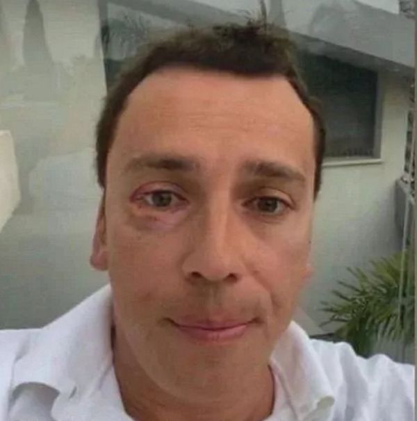 Галкин